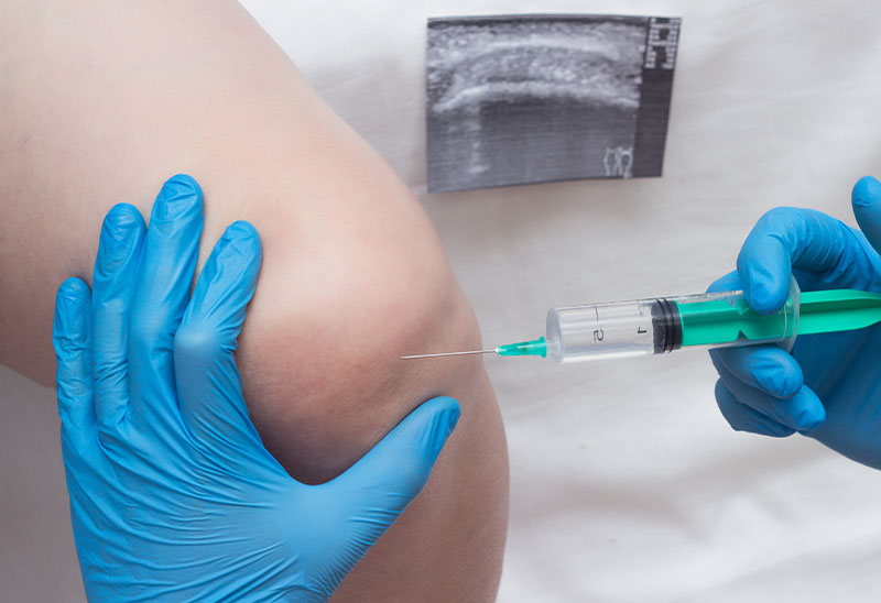 A doctor injects a medical injection of chondroprotector and hyaluronic acid into the knee of a woman to restore the knee joint, cartilage and synovial fluid, close-up